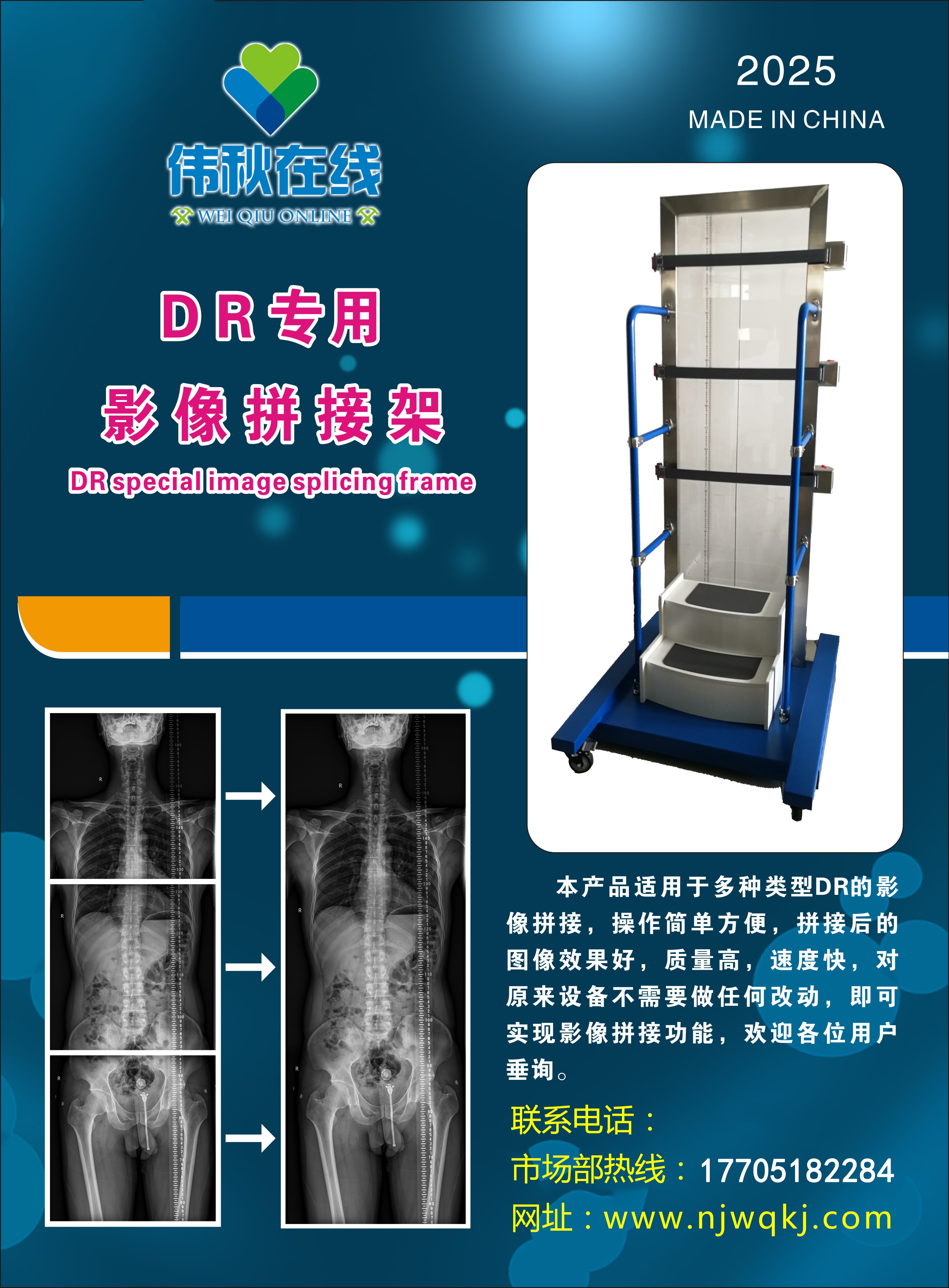 长骨拼接胸片架/DR专用影像拼接架 1