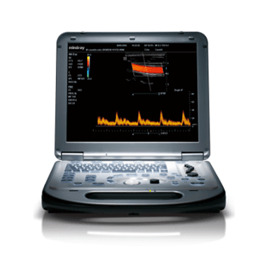 迈瑞便携M55彩超显示屏 1