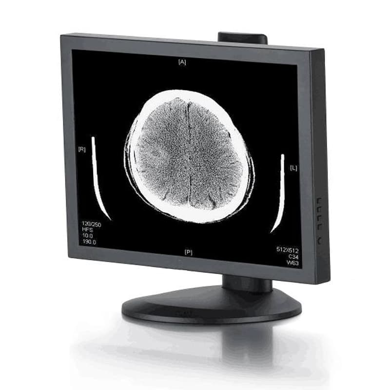 显辉G119 19 寸 1MP 灰阶显示器