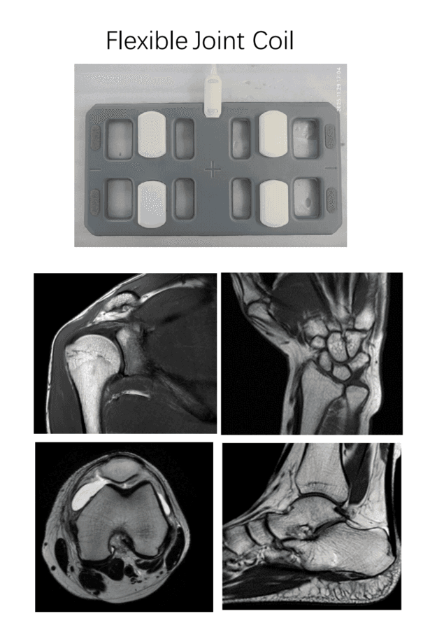 8-Channel Flexible Joint Coil for MRI 1