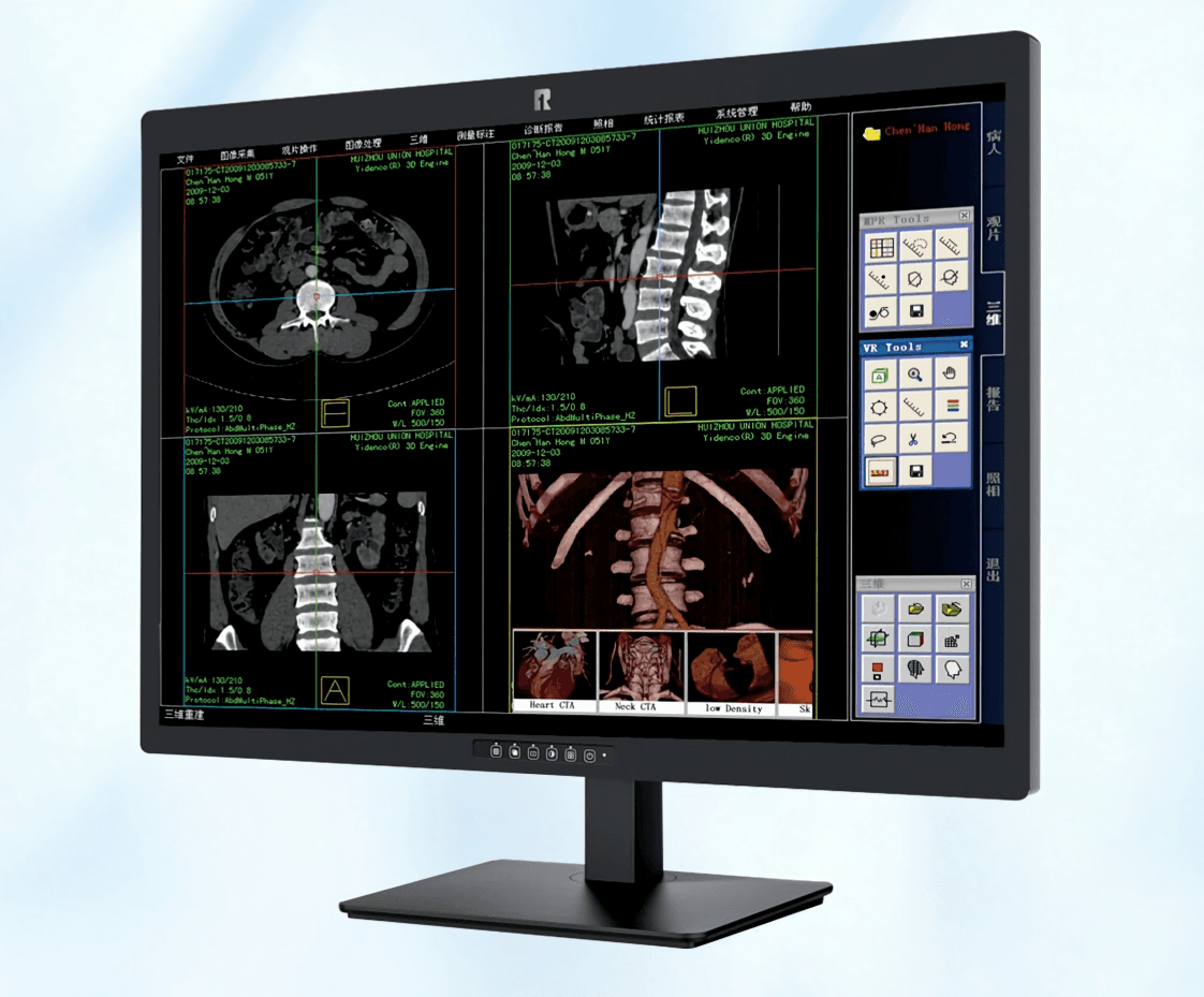 RUING Medical Monitor KL-800M